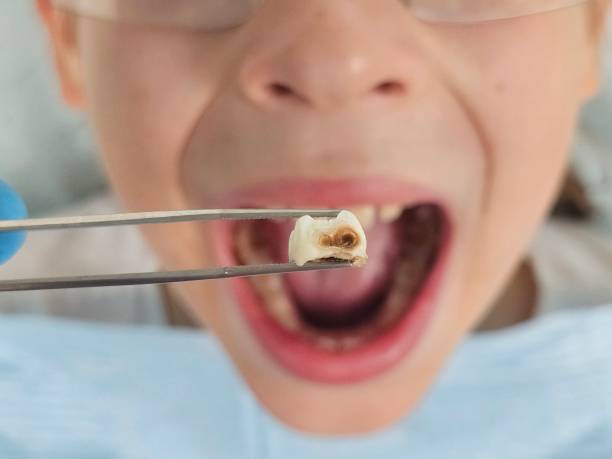 Best Pediatric Emergency Dentist in Postville, IA